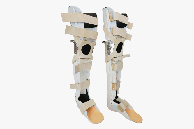 Изготовление аппарата — это изделие, предназначенная для коррекции положения конечности